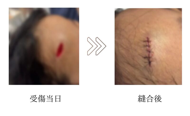 やけど、外傷にも対応しています