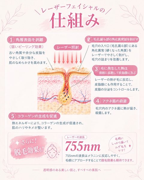 レーザーフェイシャルとレーザーシャワーのご案内
