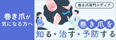巻き爪が気になる方へ