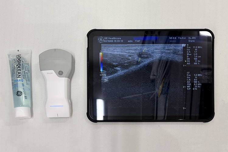 皮膚エコー検査機器 Vscan Air